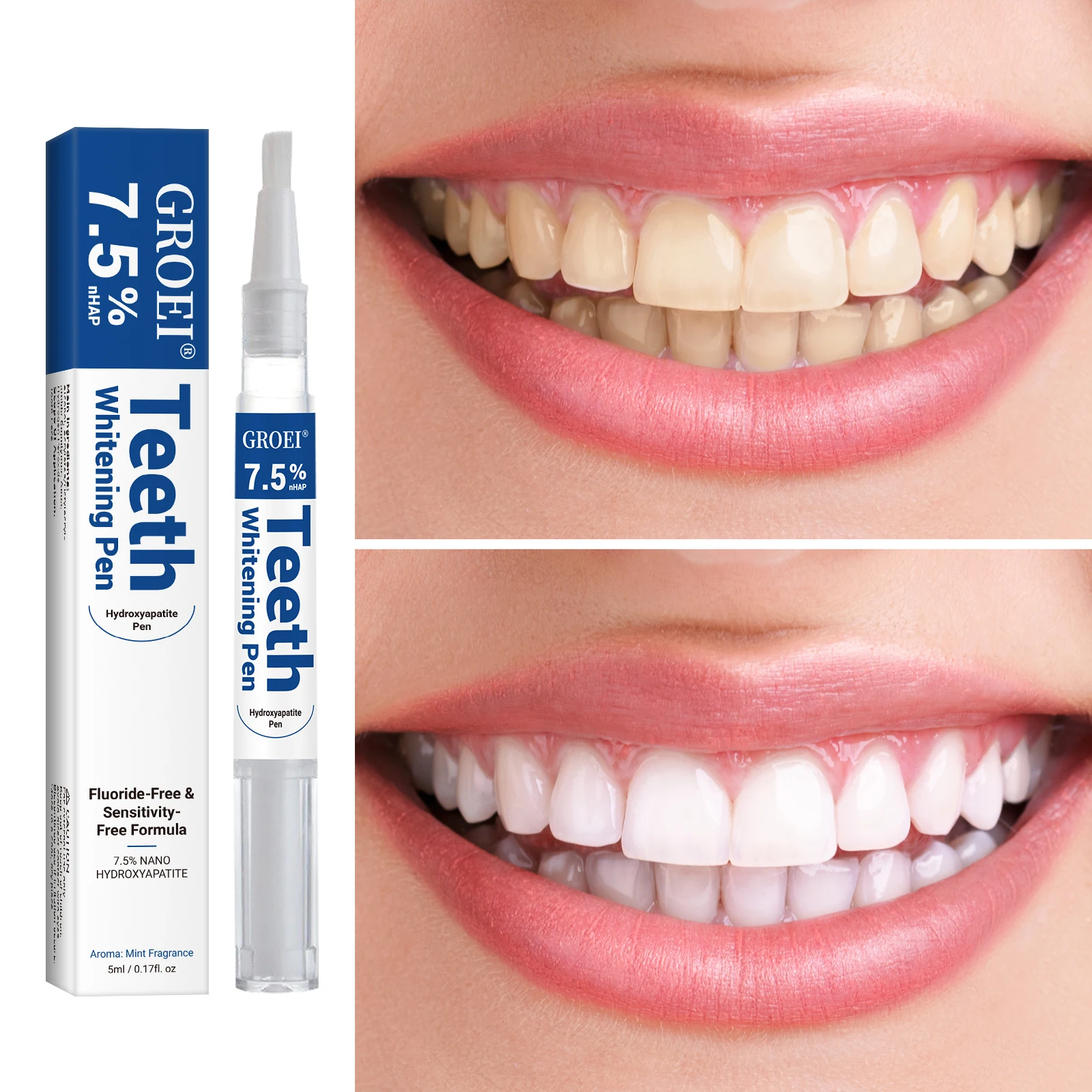 Hydroxyapatite Tand Whitening  - Teeth Whitening Clinic recensie en prijs