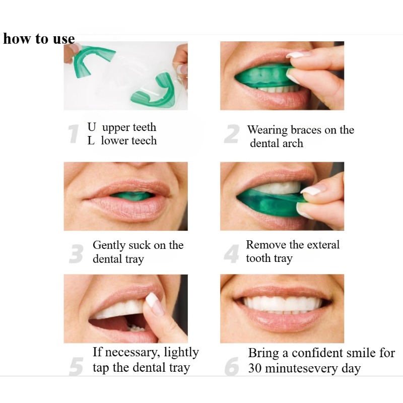 Set Tanden Whitening Lade U-vo - Teeth Whitening For Trays recensie en prijs