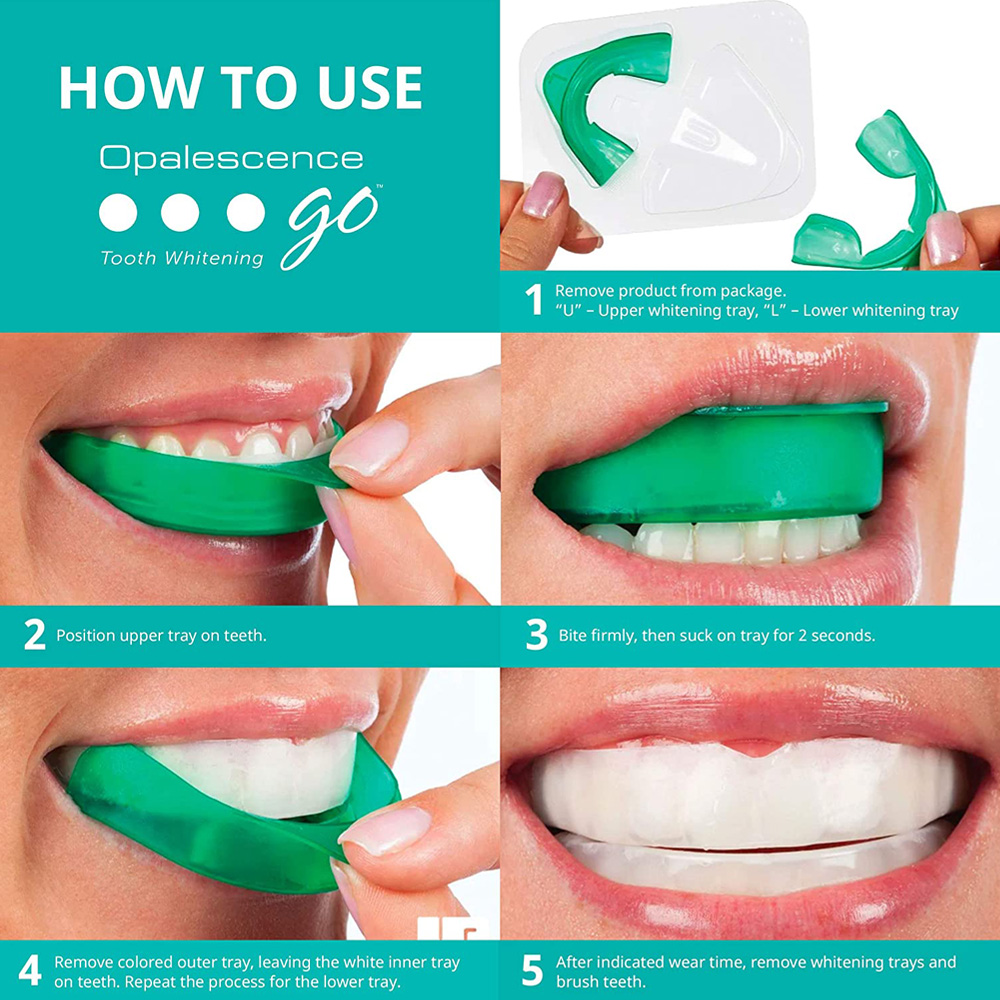 Waterstofperoxide Voor Tanden  - Teeth Whitening For Trays recensie en prijs