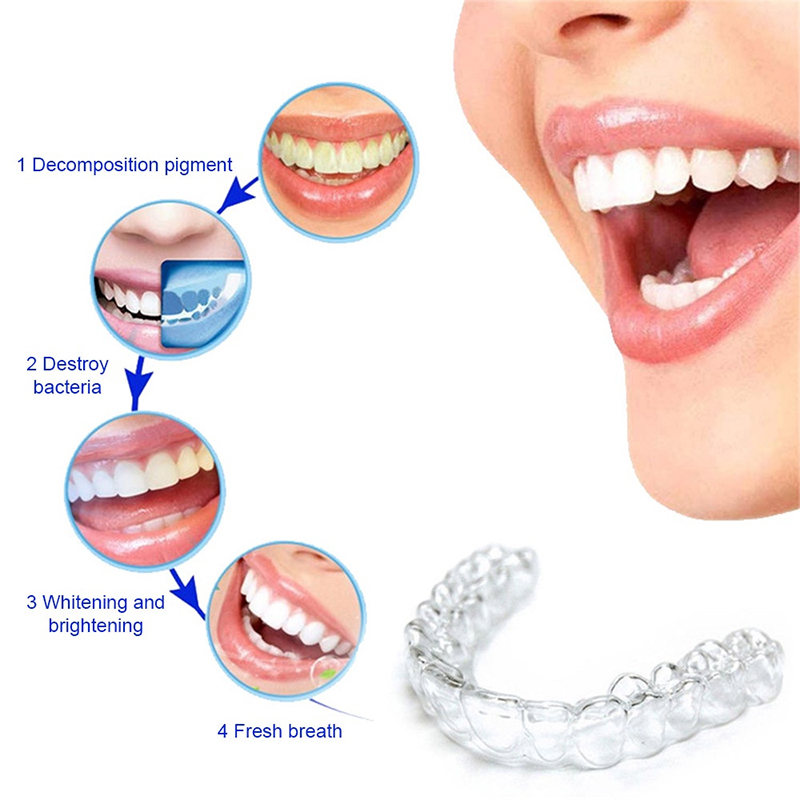 Comfort Fit Siliconen Mondbakj - Teeth Whitening For Trays recensie en prijs