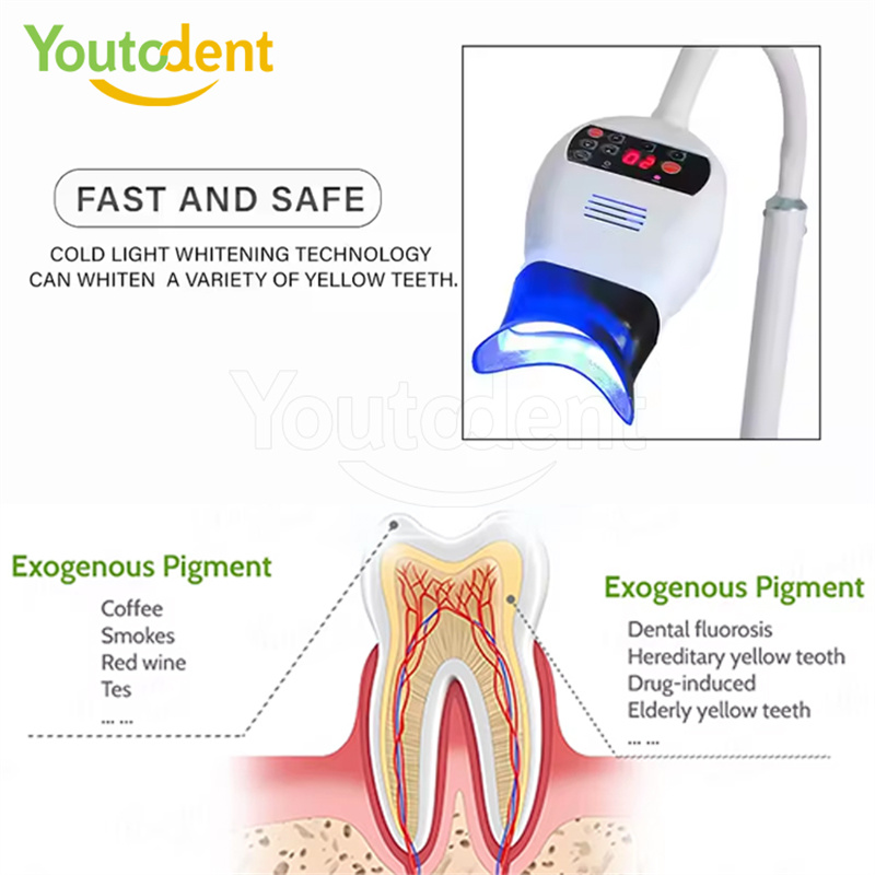 Professionele Tandheelkundige  - Teeth Whitening With Led Light recensie en prijs