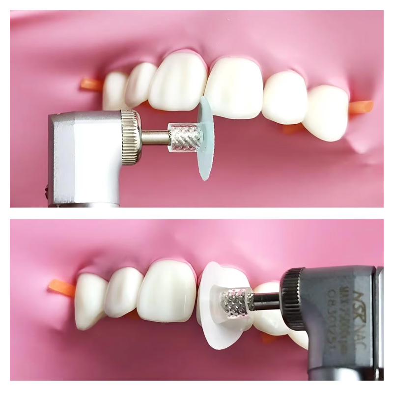 40 Stuks Tandheelkundige Polij - Teeth Whitening Express recensie en prijs