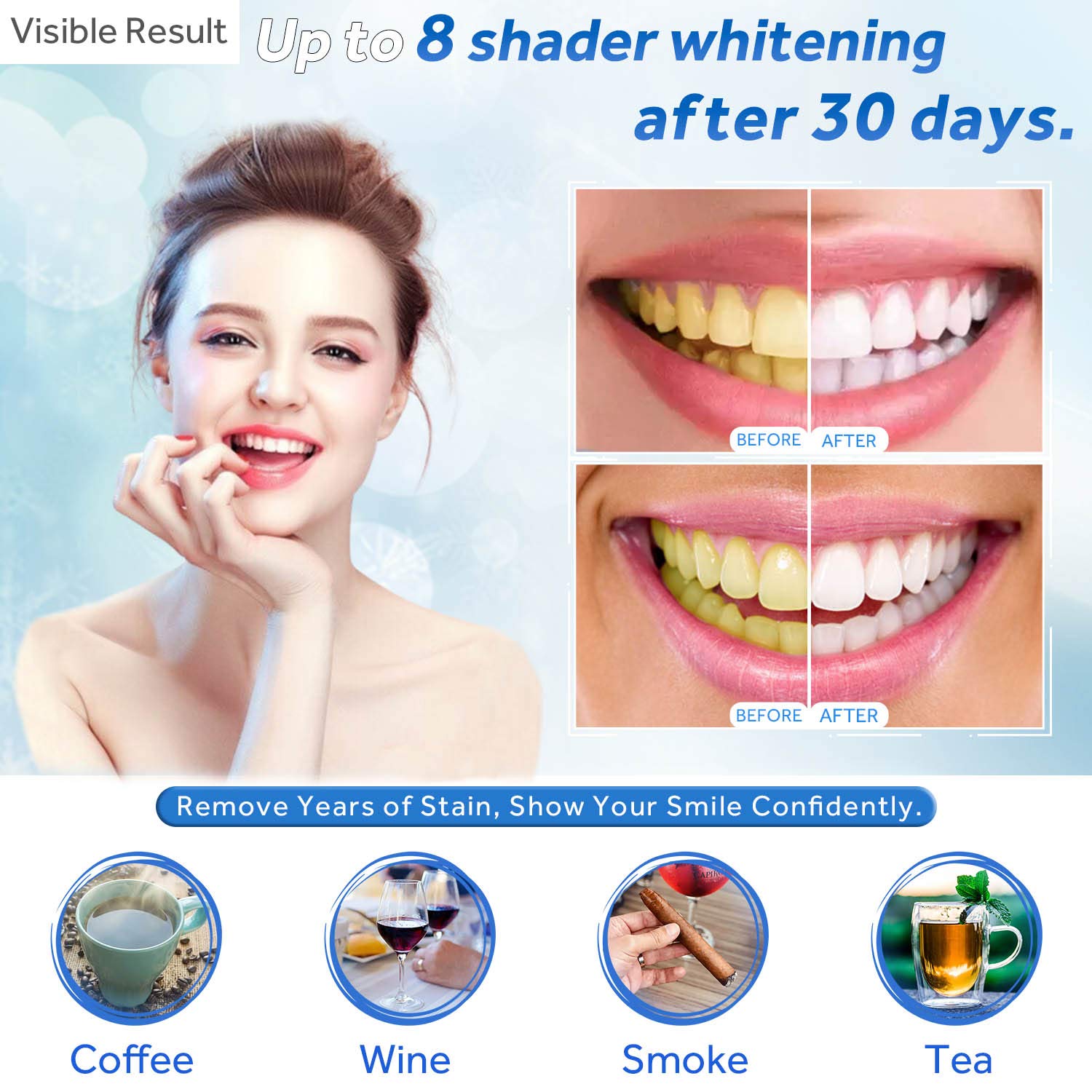 Tanden Whitening Gel Refill Sp - Teeth Whitening For Trays recensie en prijs