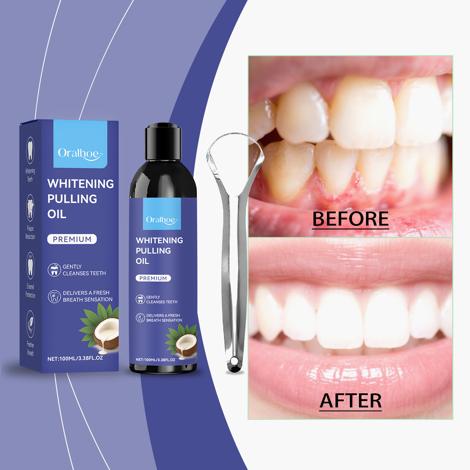Pepermunt-kokosolie mondwater  - Teeth Whitening With Coconut Oil recensie en prijs