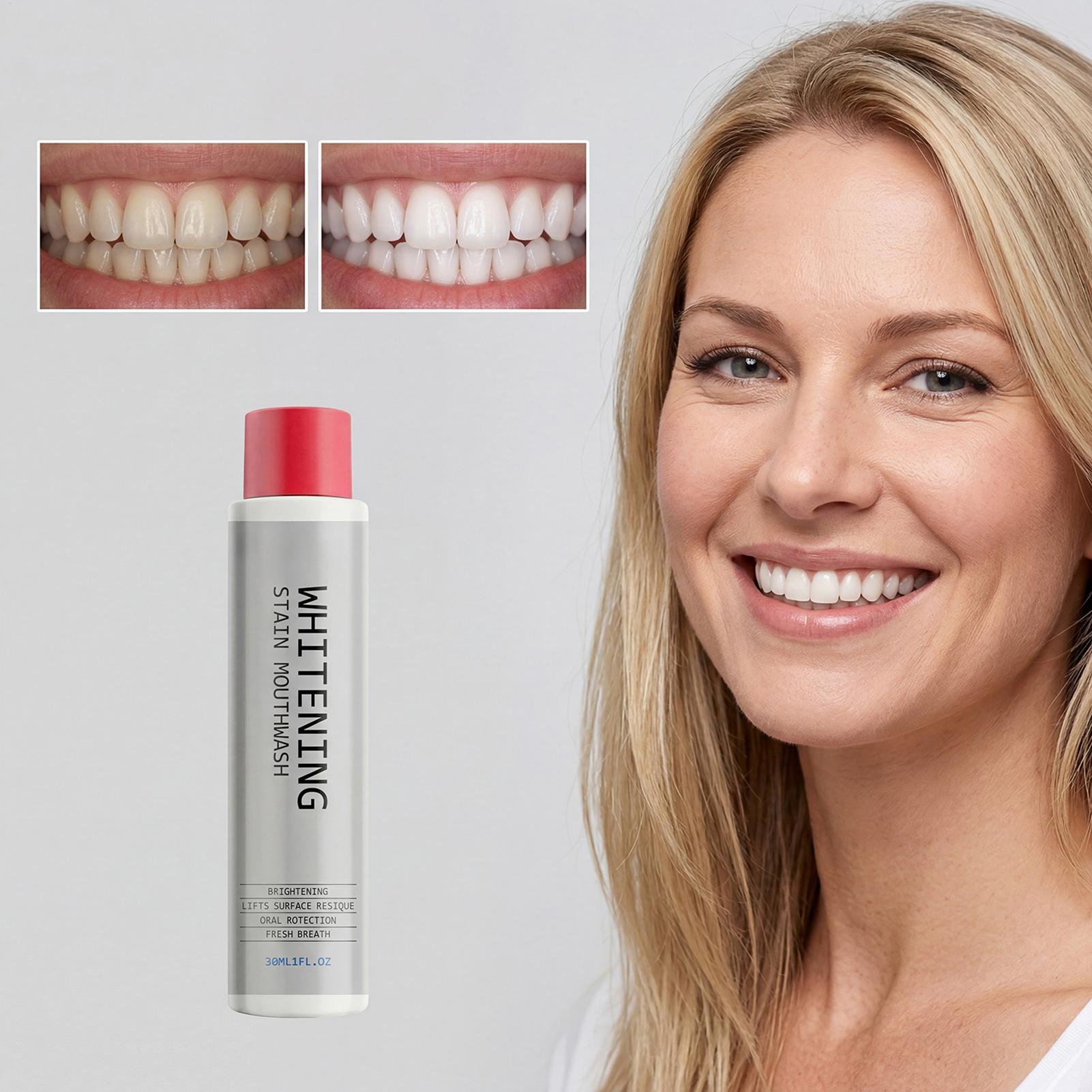 30ml Vlekkenverwijderende Mond - Whitening Mouthwash recensie en prijs